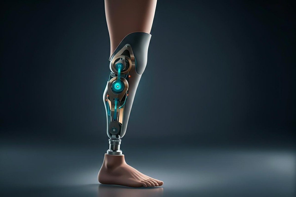 Il ginocchio bionico che rivoluziona il futuro delle protesi