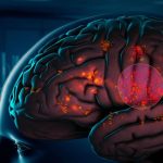 Scoperto il meccanismo che scatena la malattia di Parkinson